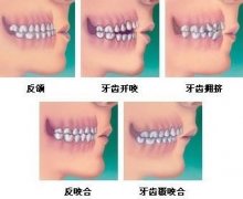 【从齿健康成长】——儿童替牙期早期矫正公开课