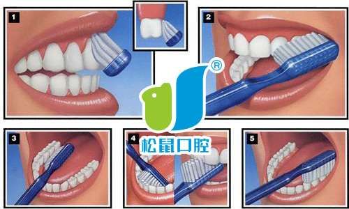 正确的刷牙方法